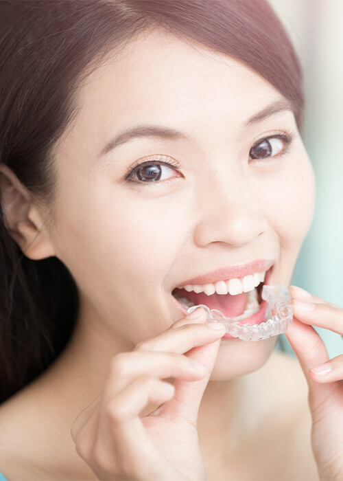 Young woman placing her Invisalign clear aligners